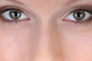 Prolonger la jeunesse du contour de ses yeux